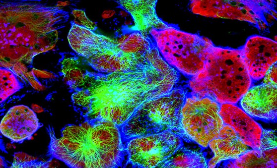 Cancer Tools organoids RF image link