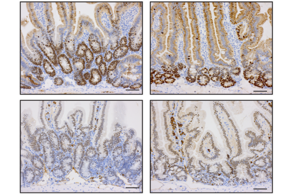 Cancer Immunology publication image link