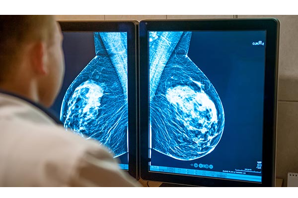 breast screening 